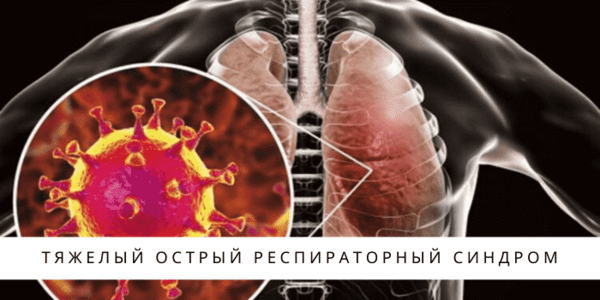 tjazhelyj-ostryj-respiratornyj-sindrom.png