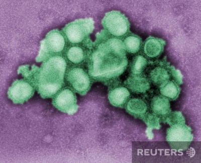 Так выглядит H1N1.jpg (189.91 KiB) Просмотров: 3273 Так выглядит H1N1.jpg