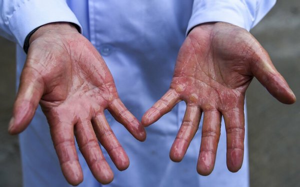 dezinfekavimo-skystis-83683743.jpg (55.3 KiB) Просмотров: 1079 dezinfekavimo-skystis-83683743.jpg